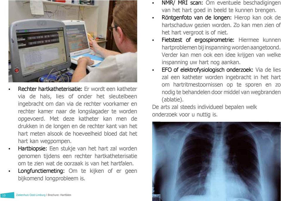 Hartbiopsie: Een stukje van het hart zal worden genomen tijdens een rechter hartkatheterisatie om te zien wat de oorzaak is van het hartfalen.