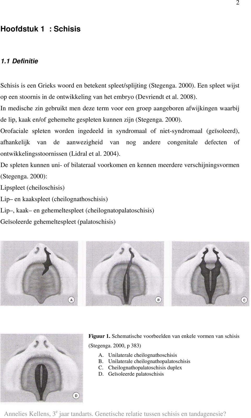 Orofaciale spleten worden ingedeeld in syndromaal of niet-syndromaal (geïsoleerd), afhankelijk van de aanwezigheid van nog andere congenitale defecten of ontwikkelingsstoornissen (Lidral et al. 2004).