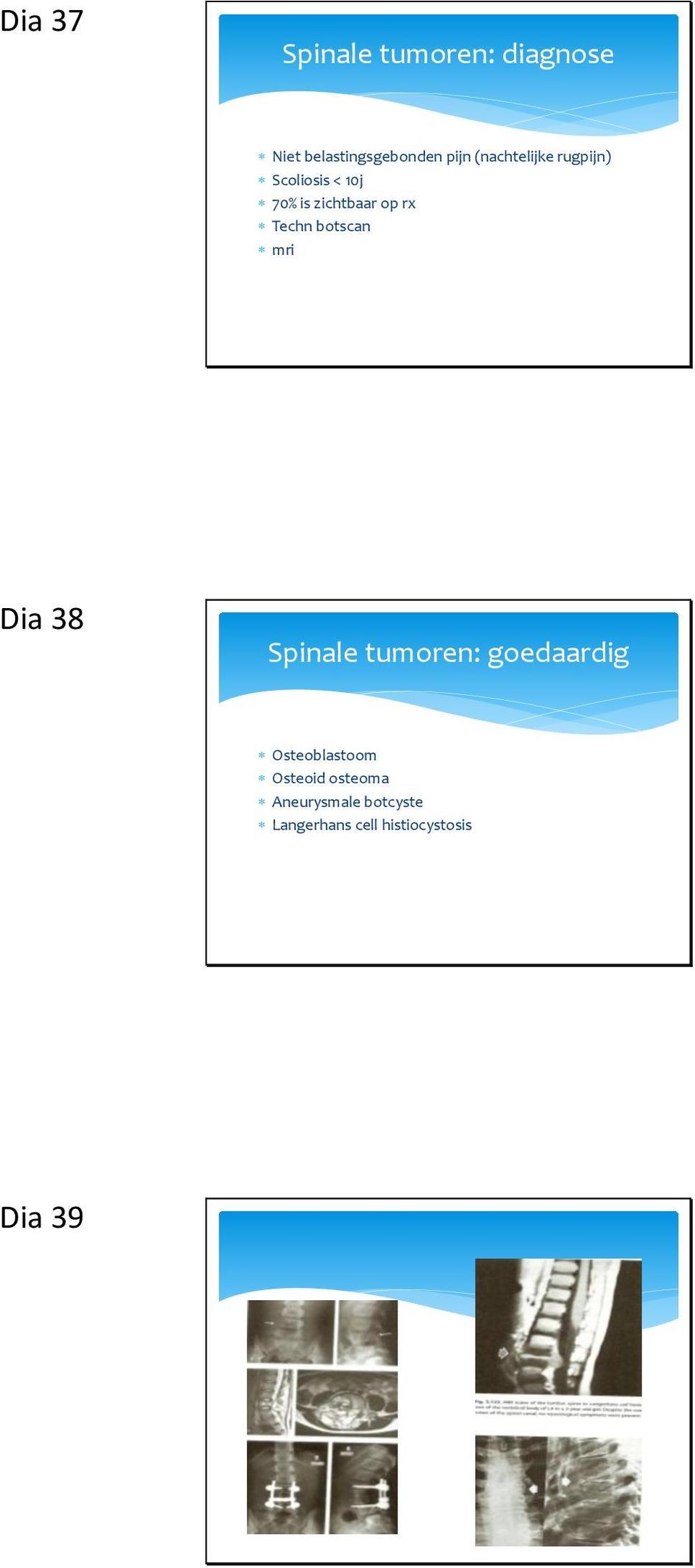 Techn botscan mri Dia 38 Spinale tumoren: goedaardig