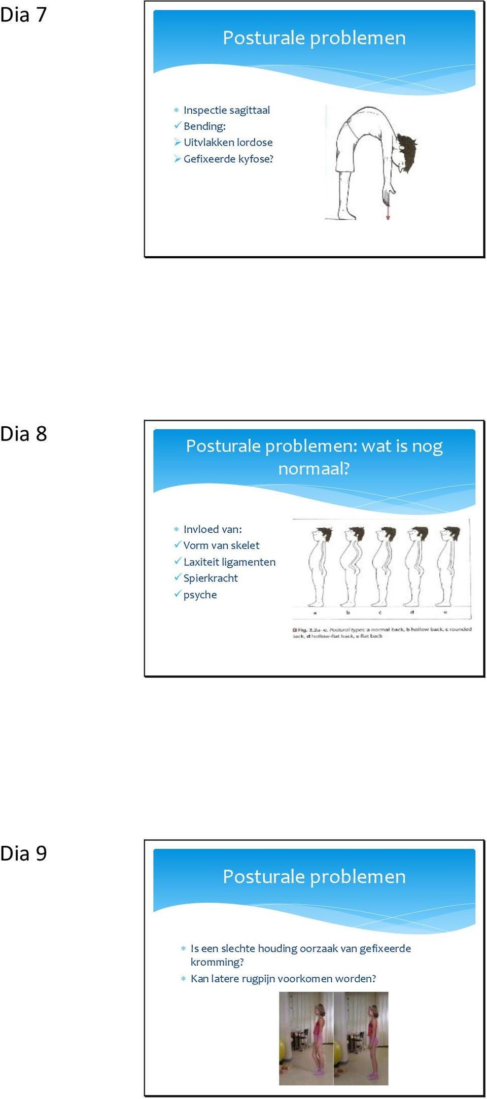 Invloed van: Vorm van skelet Laxiteit ligamenten Spierkracht psyche Dia 9