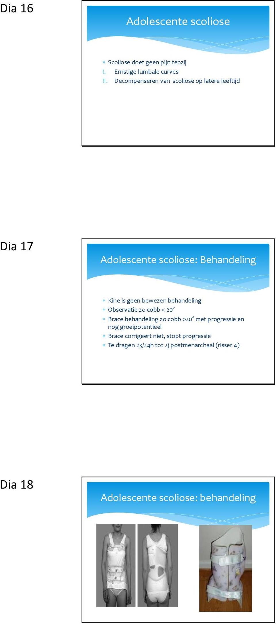 behandeling Observatie zo cobb < 20 Brace behandeling zo cobb >20 met progressie en nog groeipotentieel