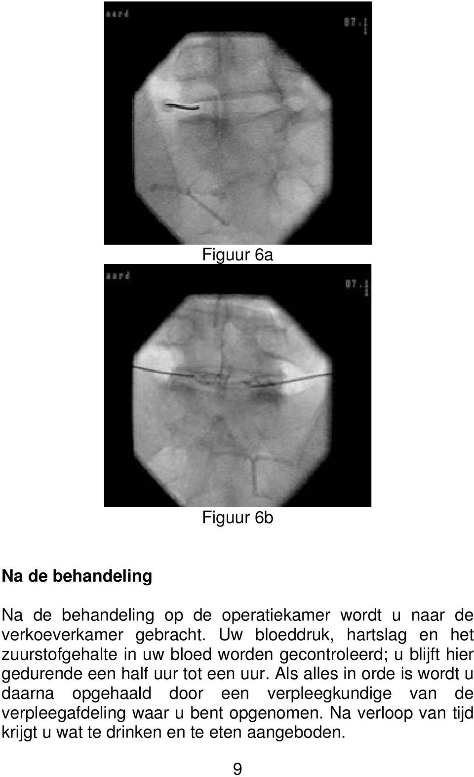 Uw bloeddruk, hartslag en het zuurstofgehalte in uw bloed worden gecontroleerd; u blijft hier gedurende een