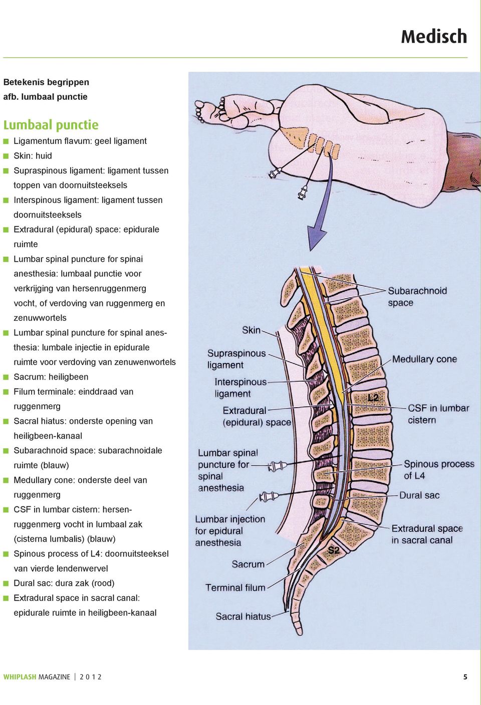 doornuitsteeksels Extradural (epidural) space: epidurale ruimte Lumbar spinal puncture for spinai anesthesia: lumbaal punctie voor verkrijging van hersenruggenmerg vocht, of verdoving van ruggenmerg