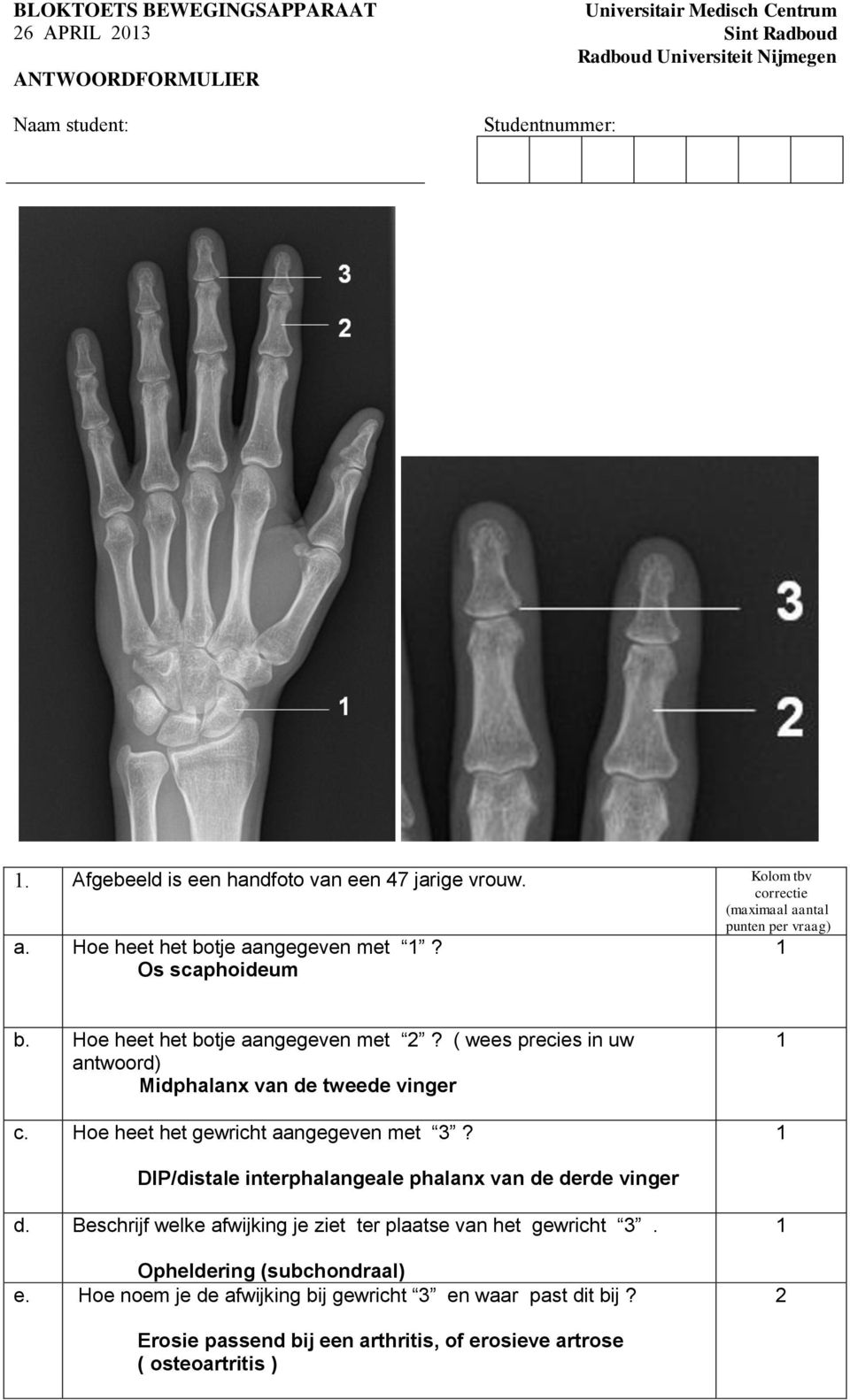 Hoe heet het gewricht aangegeven met 3? DIP/distale interphalangeale phalanx van de derde vinger d.