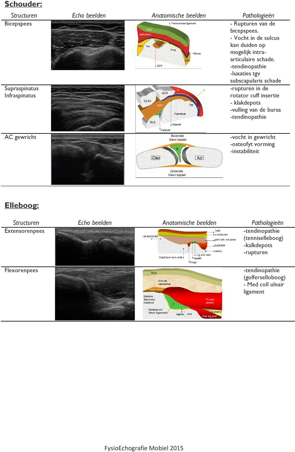 -luxaties tgv subscapularis schade Supraspinatus Infraspinatus -rupturen in de rotator cuff insertie - klakdepots -vulling van de bursa AC