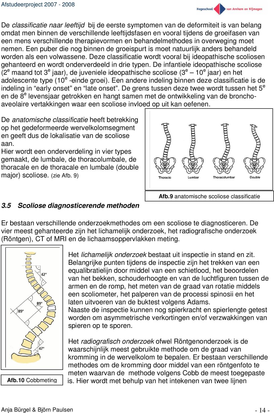 Deze classificatie wordt vooral bij ideopathische scoliosen gehanteerd en wordt onderverdeeld in drie typen.