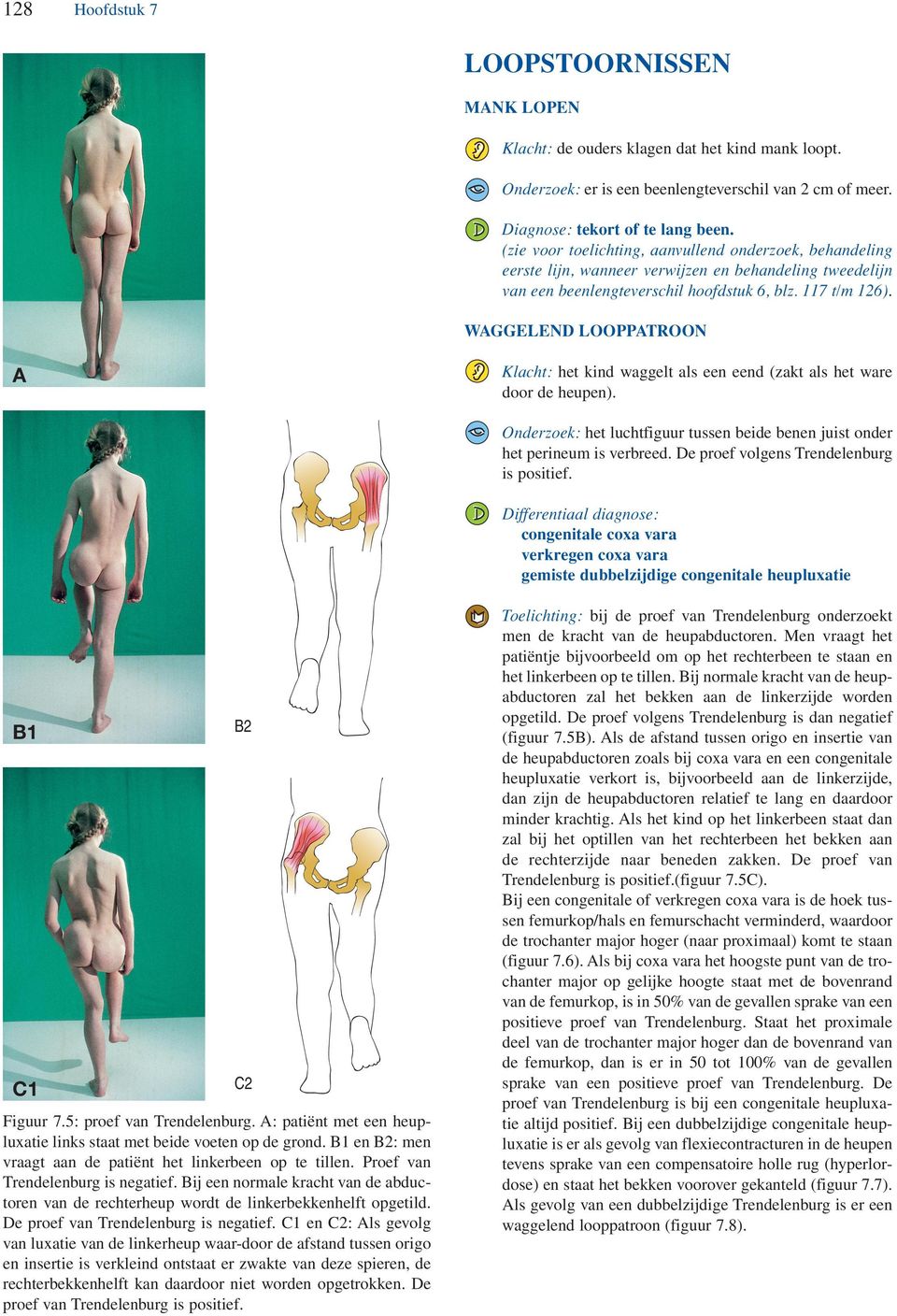 WGGELEND LOOPPTROON Klacht: het kind waggelt als een eend (zakt als het ware door de heupen). Onderzoek: het luchtfiguur tussen beide benen juist onder het perineum is verbreed.