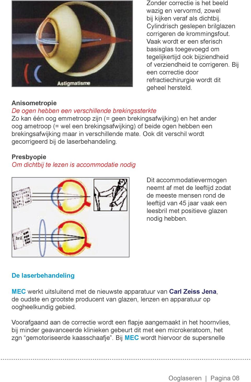 Anisometropie De ogen hebben een verschillende brekingssterkte Zo kan één oog emmetroop zijn (= geen brekingsafwijking) en het ander oog ametroop (= wel een brekingsafwijking) of beide ogen hebben