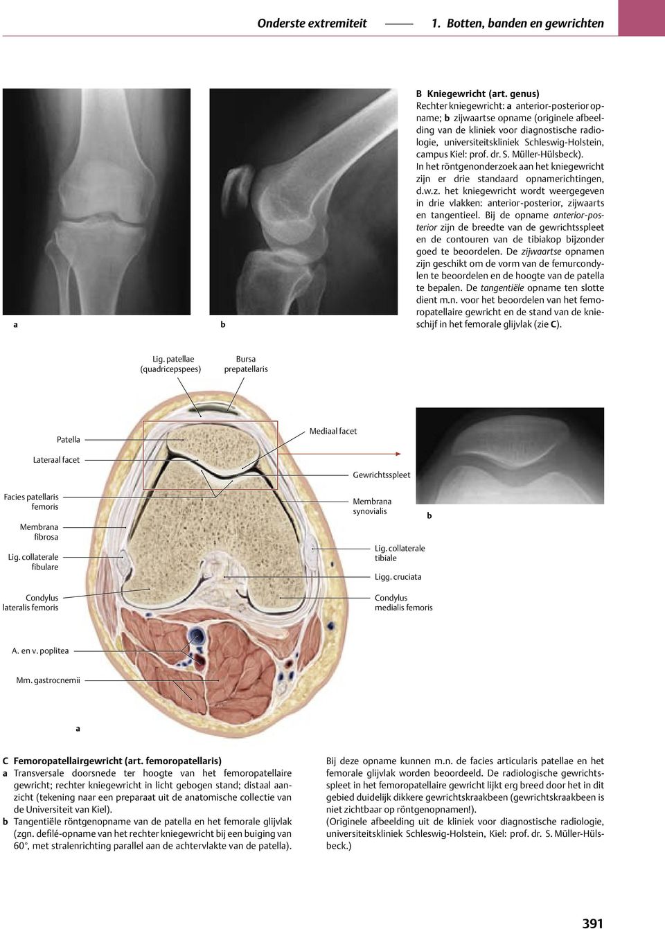 prof. dr. S. Müller-Hülsbeck). In het röntgenonderzoek aan het kniegewricht zijn er drie standaard opnamerichtingen, d.w.z. het kniegewricht wordt weergegeven in drie vlakken: anterior-posterior, zijwaarts en tangentieel.