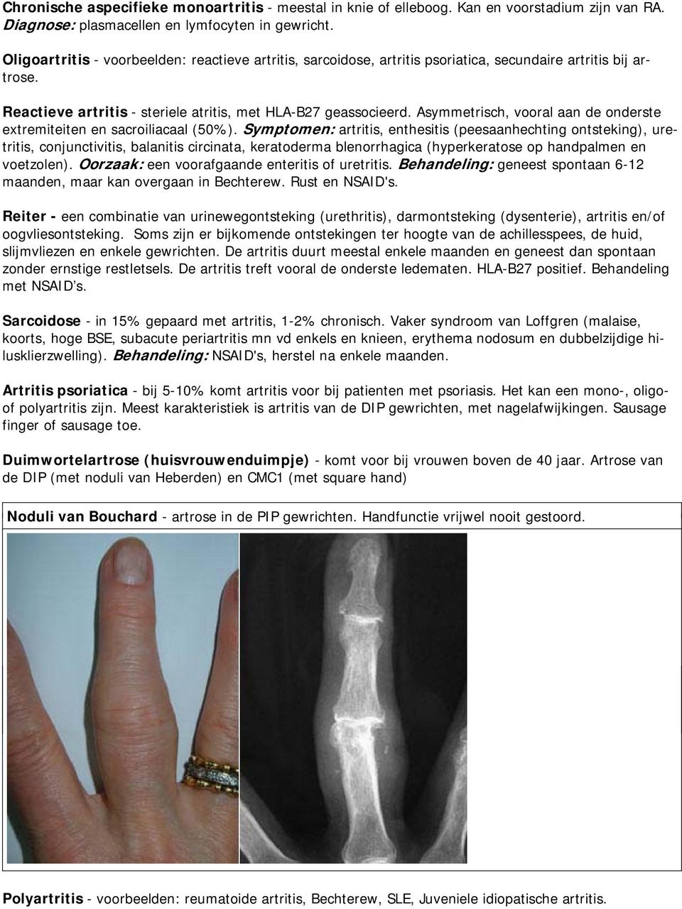 Asymmetrisch, vooral aan de onderste extremiteiten en sacroiliacaal (50%).