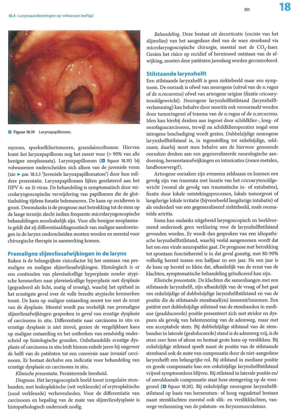 ontstaan van de afwijking, moeten deze patiënten jarenlang worden gecontroleerd. Figuur 18.19 Larynxpapillomen. speekselkliertumoren, granulaireceltumor.