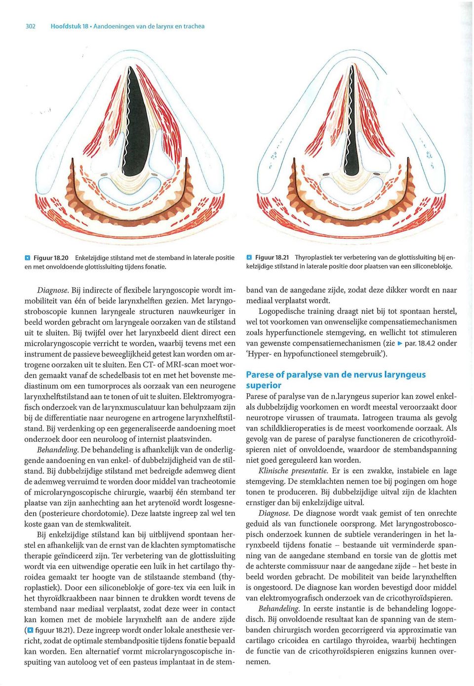 Met laryngostroboscopie kunnen laryngeale structuren nauwkeuriger in beeld worden gebracht om laryngeale oorzaken van de stilstand uit te sluiten.