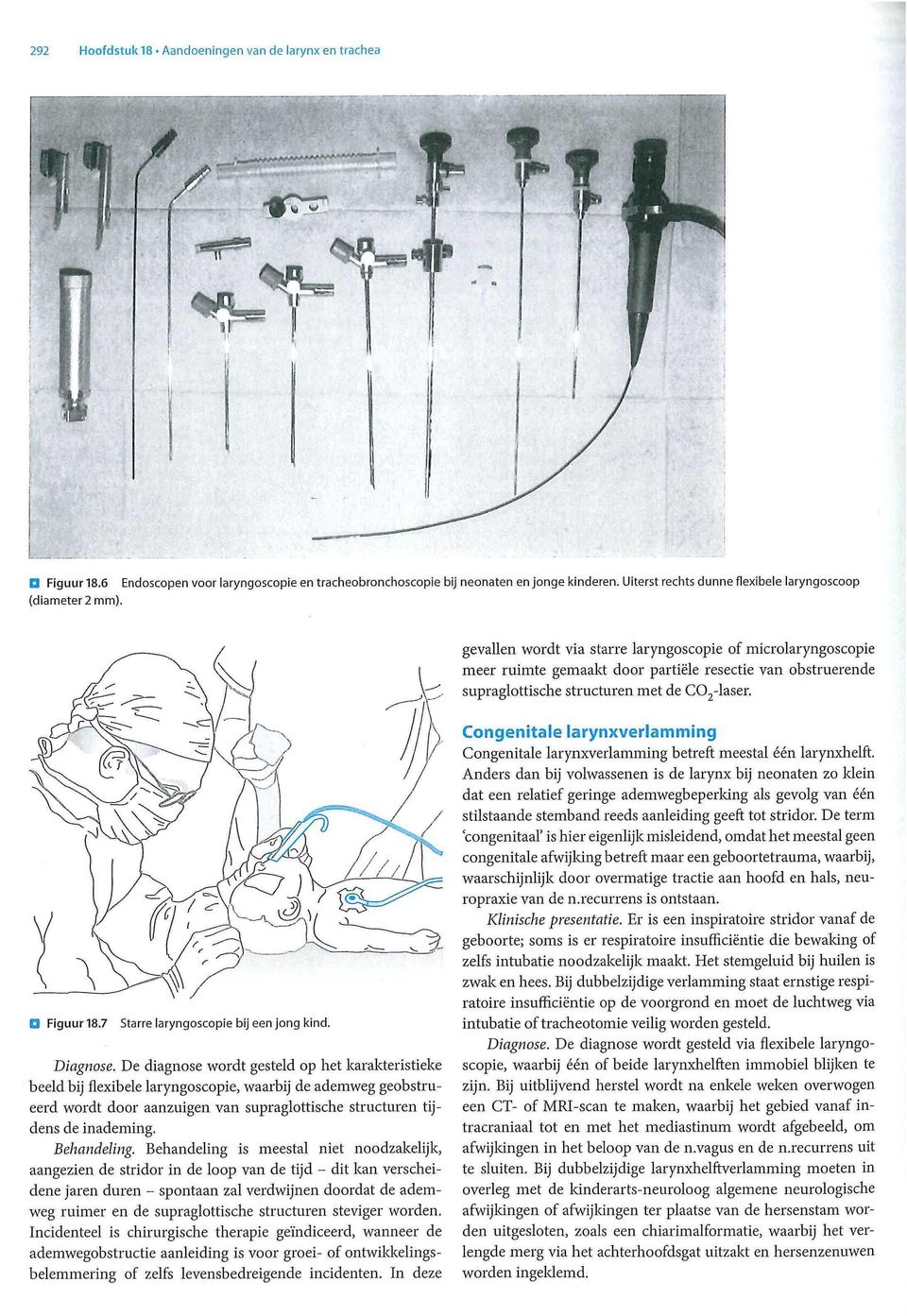 gevallen wordt via starre laryngoscopie of microiaryngoscopie meer ruimte gemaakt door partiële resectie van obstruerende supraglottische structuren met de Figuur 18.