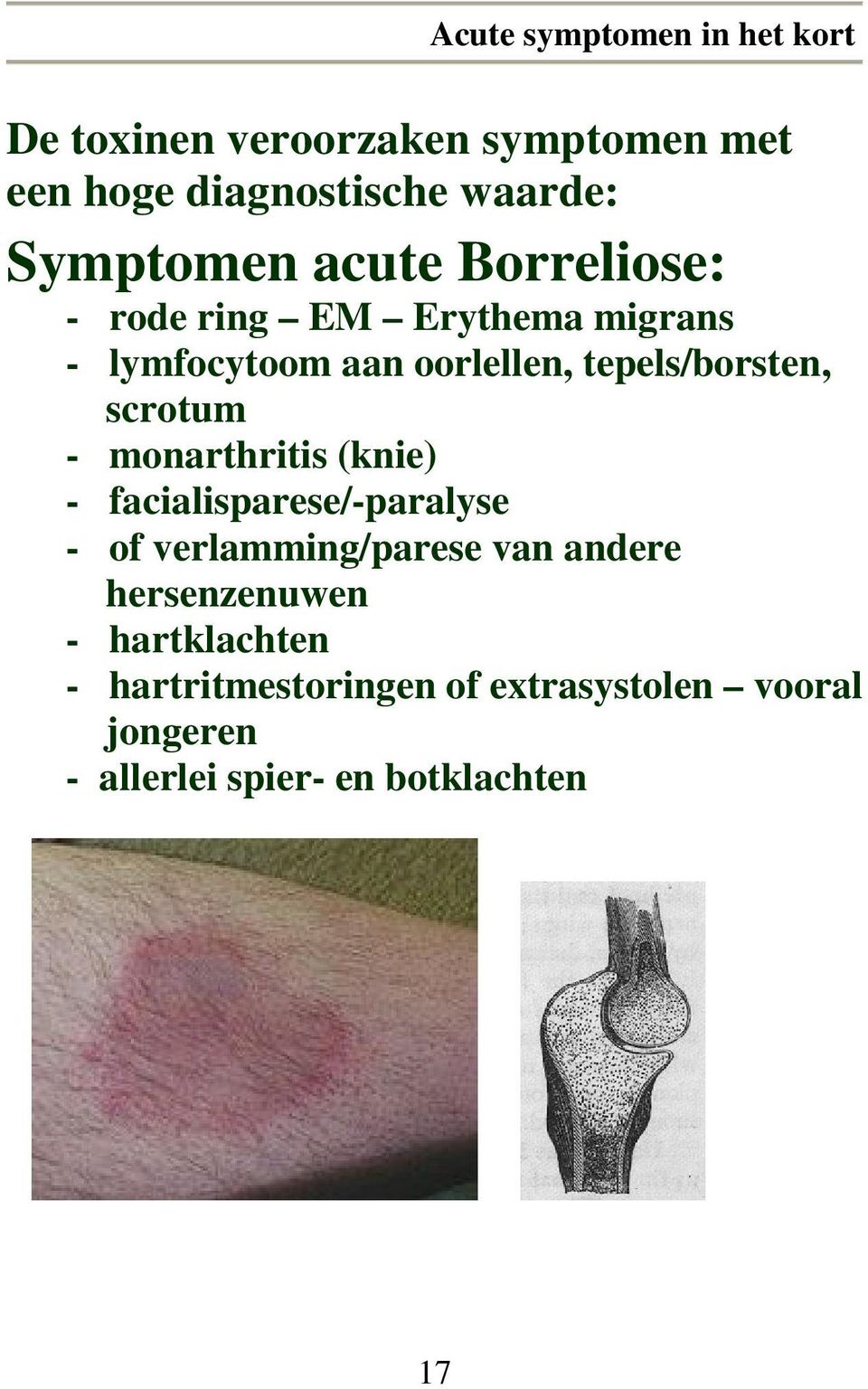 tepels/borsten, scrotum - monarthritis (knie) - facialisparese/-paralyse - of verlamming/parese van