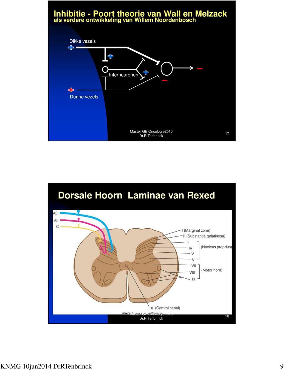 vezels Interneuronen Dunne vezels 17 Dorsale Hoorn