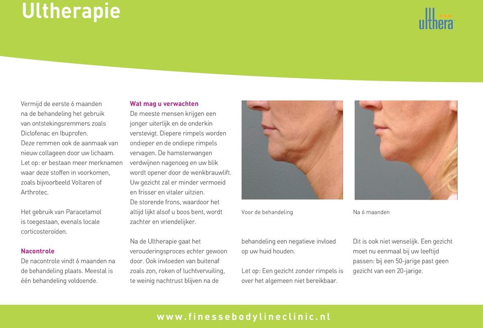 Nacontrole De nacontrole vindt 6 maanden na de behandeling plaats. Meestal is één behandeling voldoende. Wat mag u verwachten De meeste mensen krijgen een jonger uiterlijk en de onderkin verstevigt.