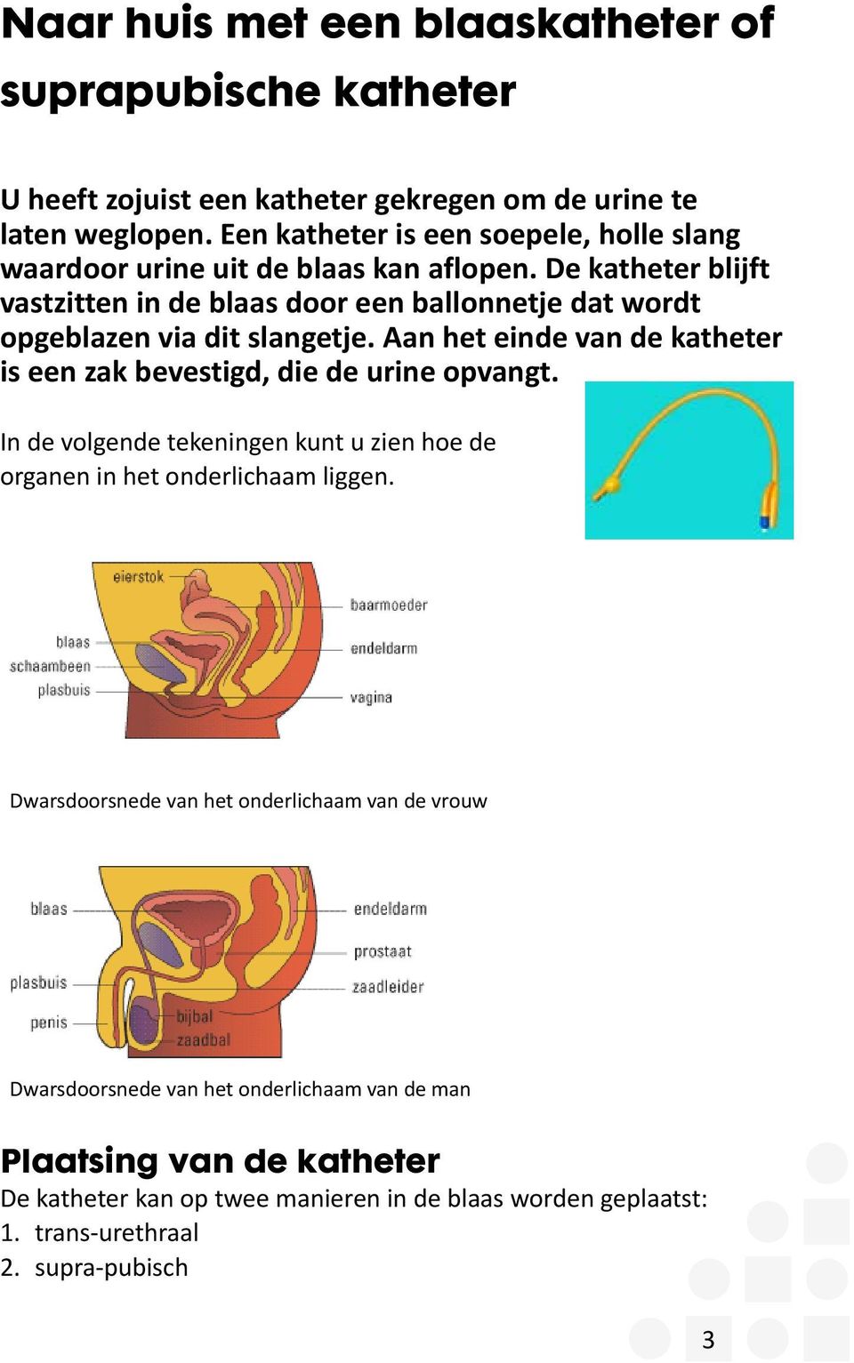 De katheter blijft vastzitten in de blaas door een ballonnetje dat wordt opgeblazen via dit slangetje.