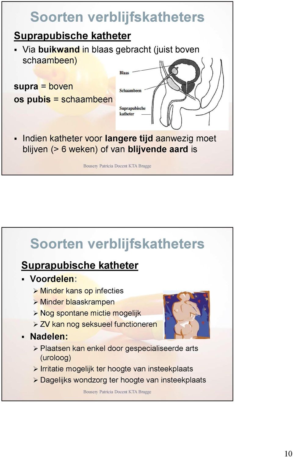 katheter Voordelen: Minder kans op infecties Minder blaaskrampen Nog spontane mictie mogelijk ZV kan nog seksueel functioneren Nadelen: