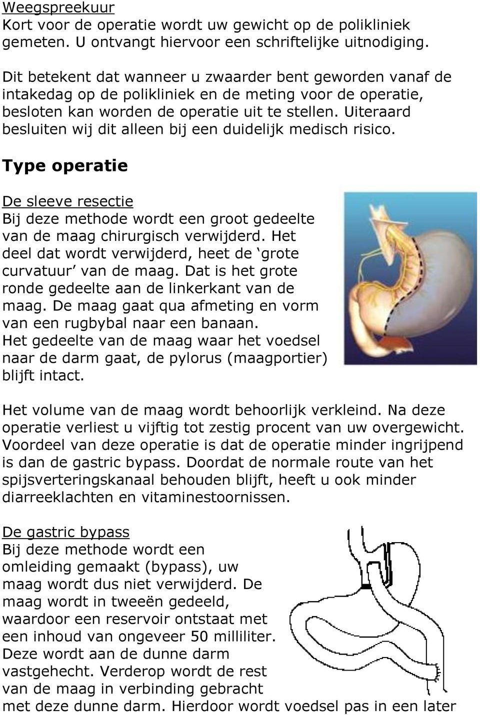 Uiteraard besluiten wij dit alleen bij een duidelijk medisch risico. Type operatie De sleeve resectie Bij deze methode wordt een groot gedeelte van de maag chirurgisch verwijderd.