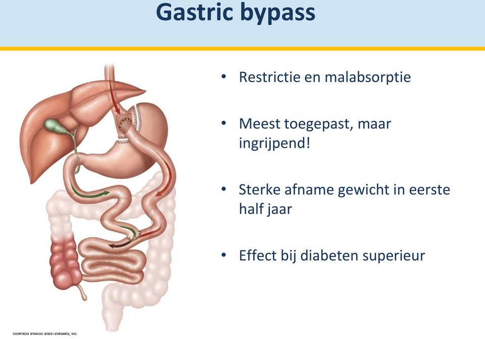 ingrijpend!