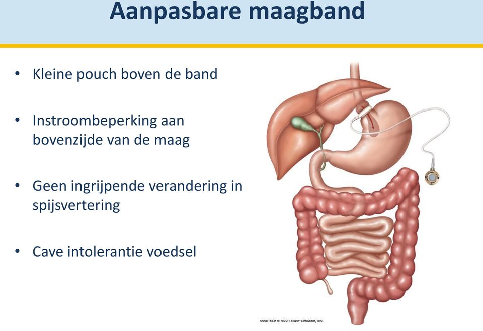 van de maag Geen ingrijpende verandering