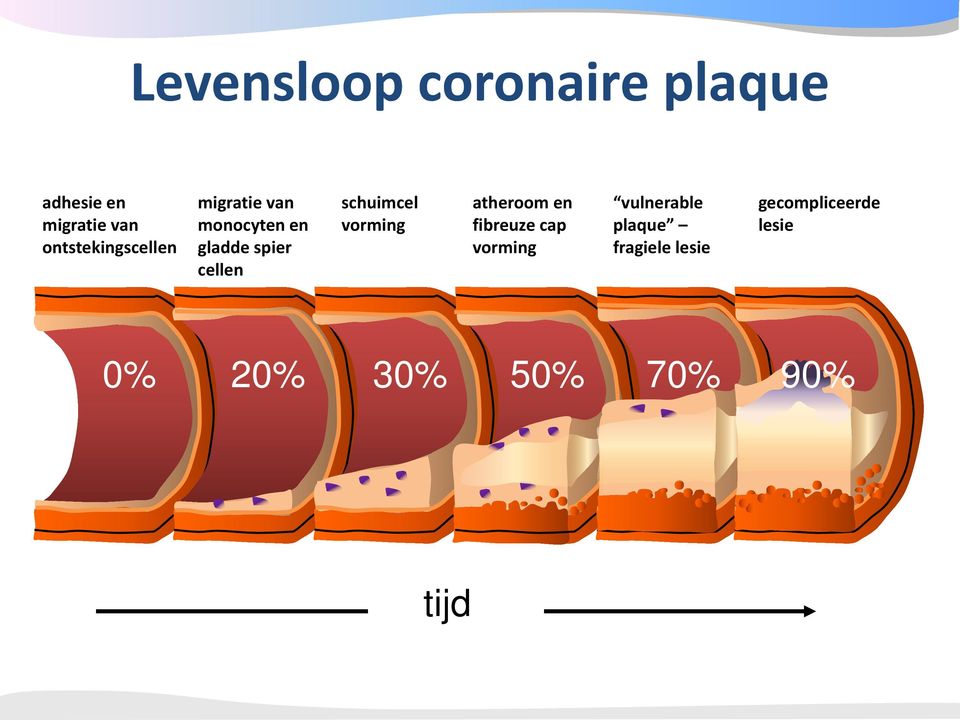 cellen schuimcel vorming atheroom en fibreuze cap vorming