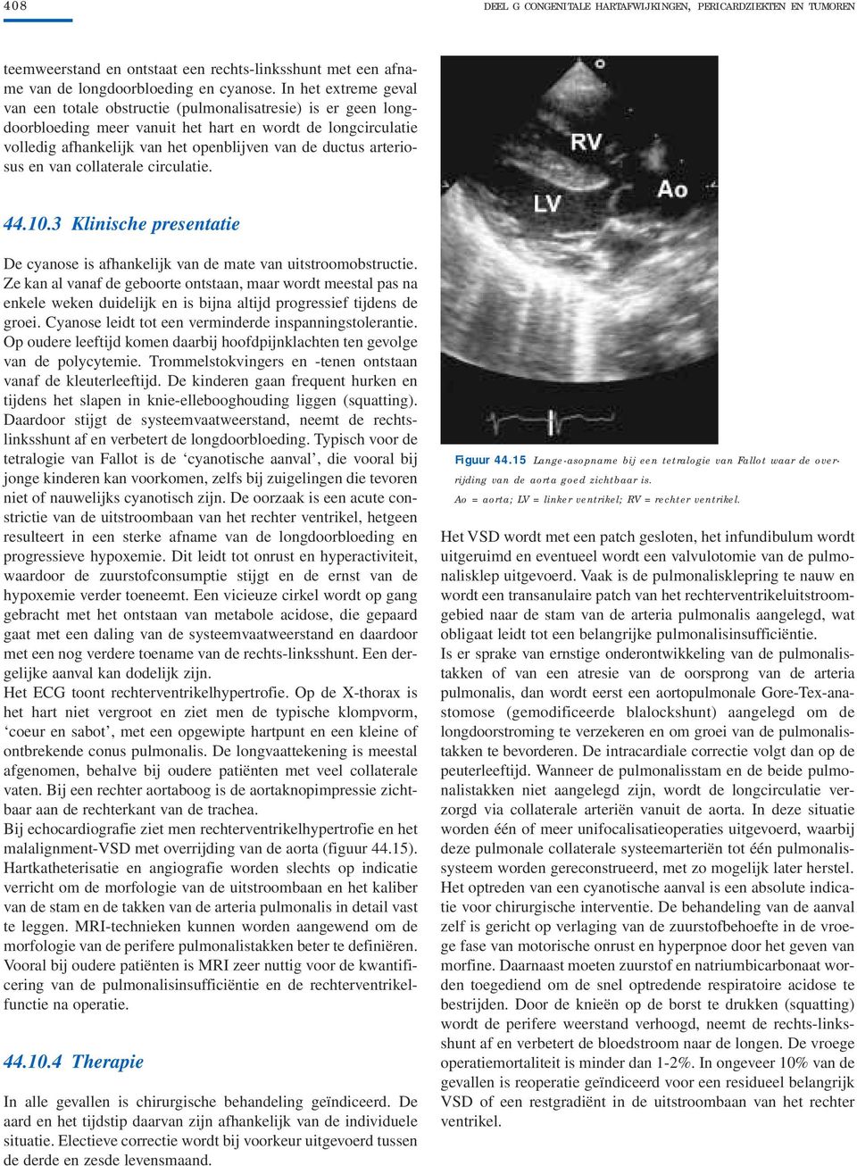 arteriosus en van collaterale circulatie. 44.10.3 Klinische presentatie De cyanose is afhankelijk van de mate van uitstroomobstructie.