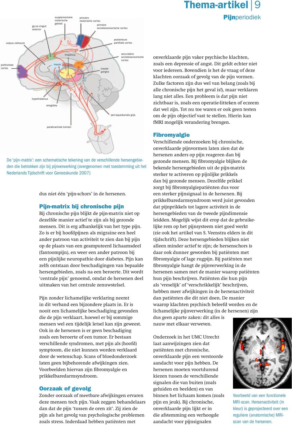 secundaire somatosensorische cortex peri-aqueductale grijs De pijn-matrix : een schematische tekening van de verschillende hersengebieden die betrokken zijn bij pijnverwerking (overgenomen met