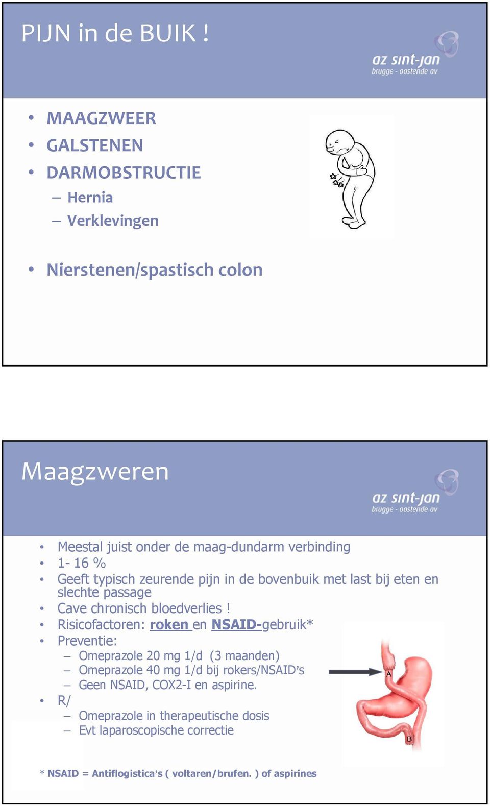 1-16 % Geeft typisch zeurende pijn in de bovenbuik met last bij eten en slechte passage Cave chronisch bloedverlies!