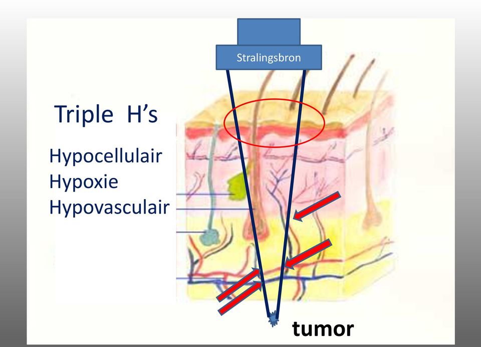 Hypocellulair