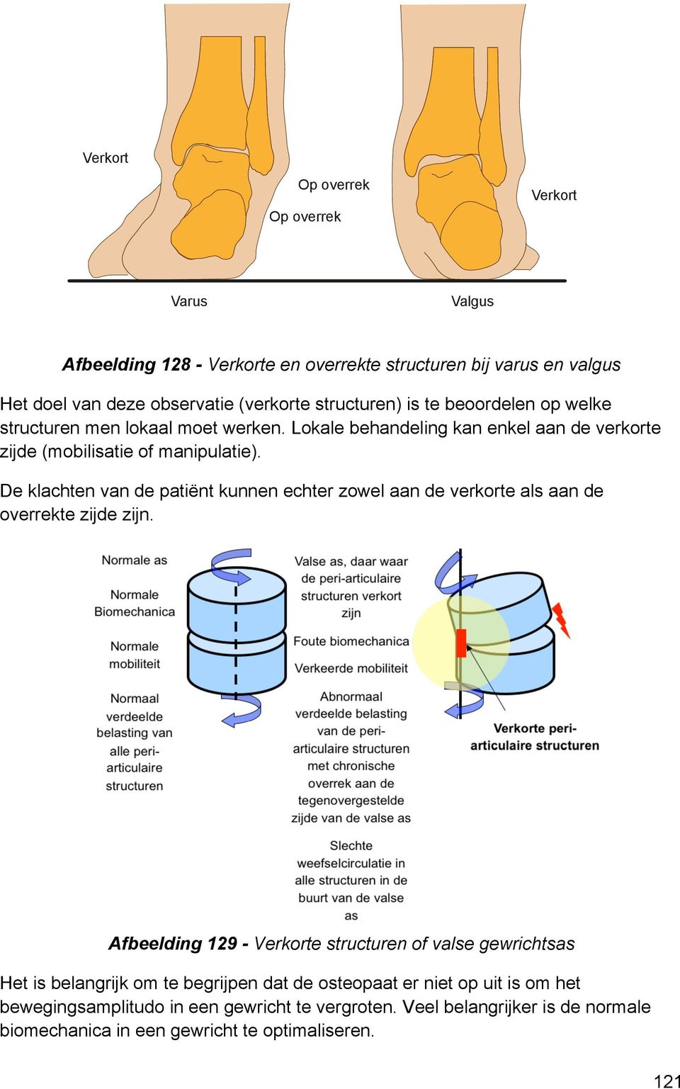 De klachten van de patiënt kunnen echter zowel aan de verkorte als aan de overrekte zijde zijn.