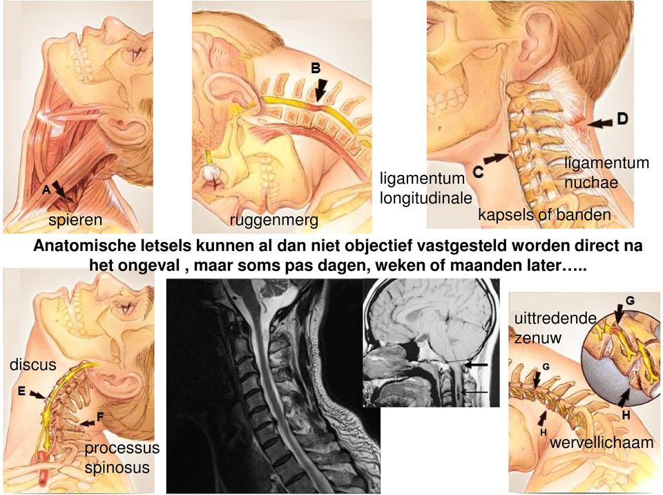 vastgesteld worden direct na het ongeval, maar soms pas dagen, weken