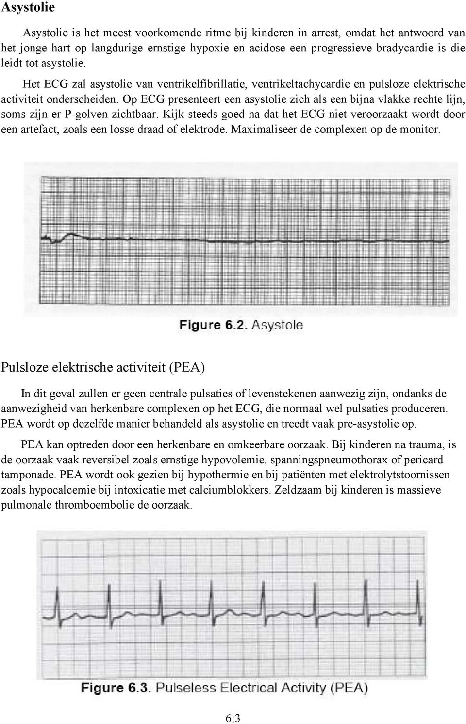 Op ECG presenteert een asystolie zich als een bijna vlakke rechte lijn, soms zijn er P-golven zichtbaar.