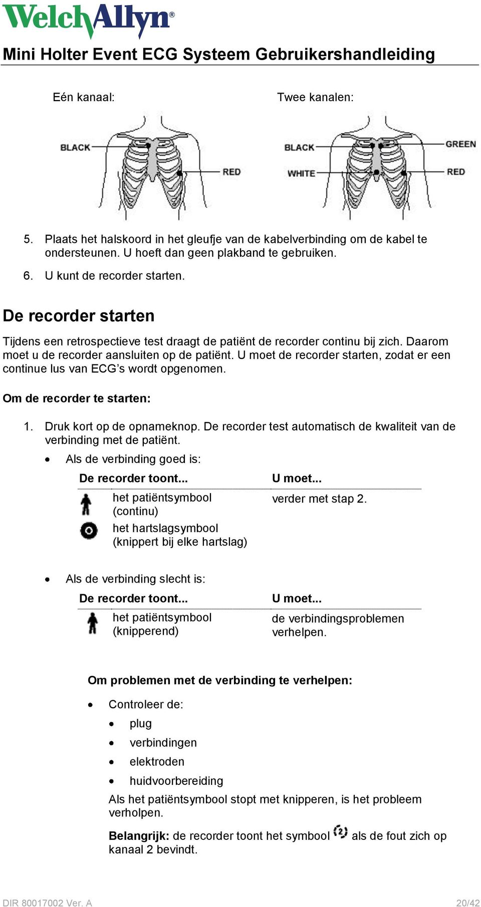 U moet de recorder starten, zodat er een continue lus van ECG s wordt opgenomen. Om de recorder te starten: 1. Druk kort op de opnameknop.