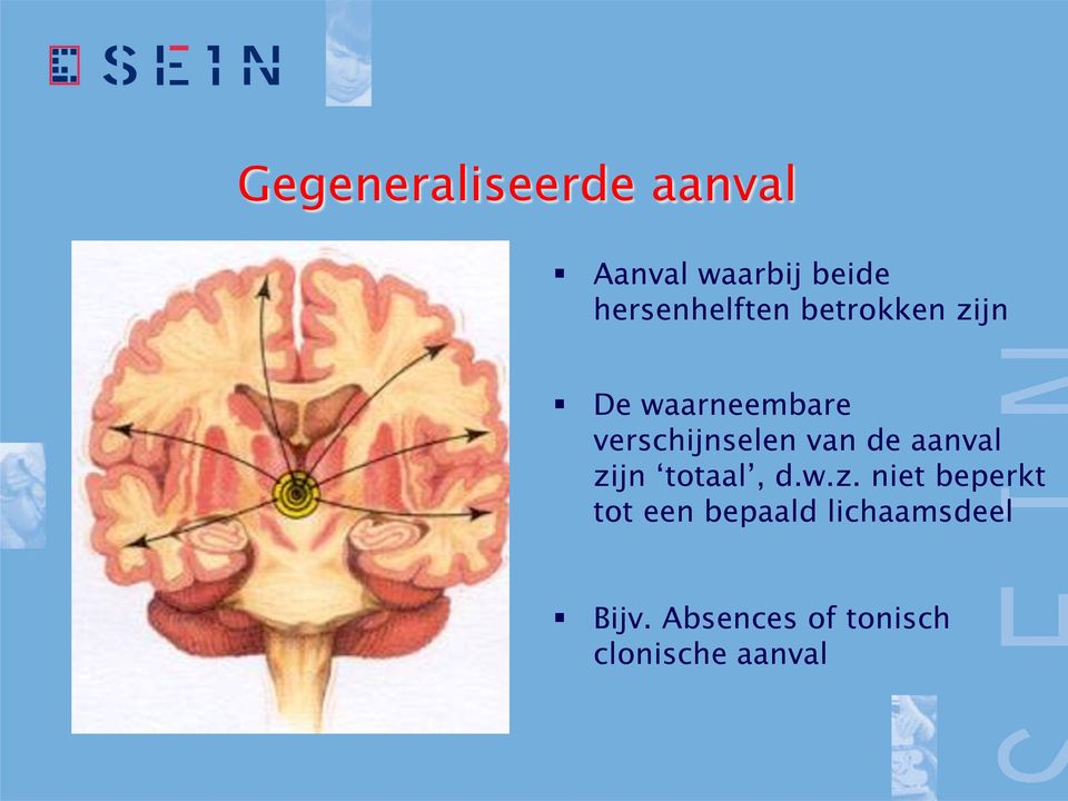 verschijnselen van de aanval zi