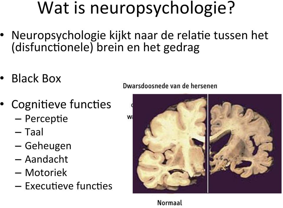 (disfunc3onele) brein en het gedrag Black Box