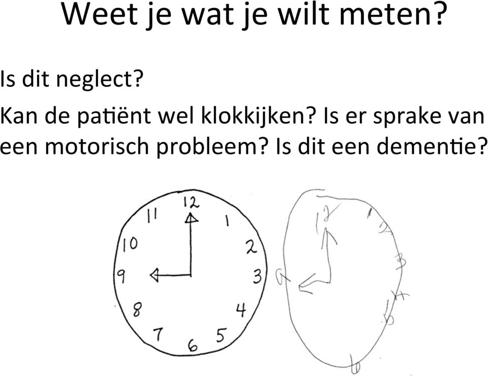 Kan de pa3ënt wel klokkijken?