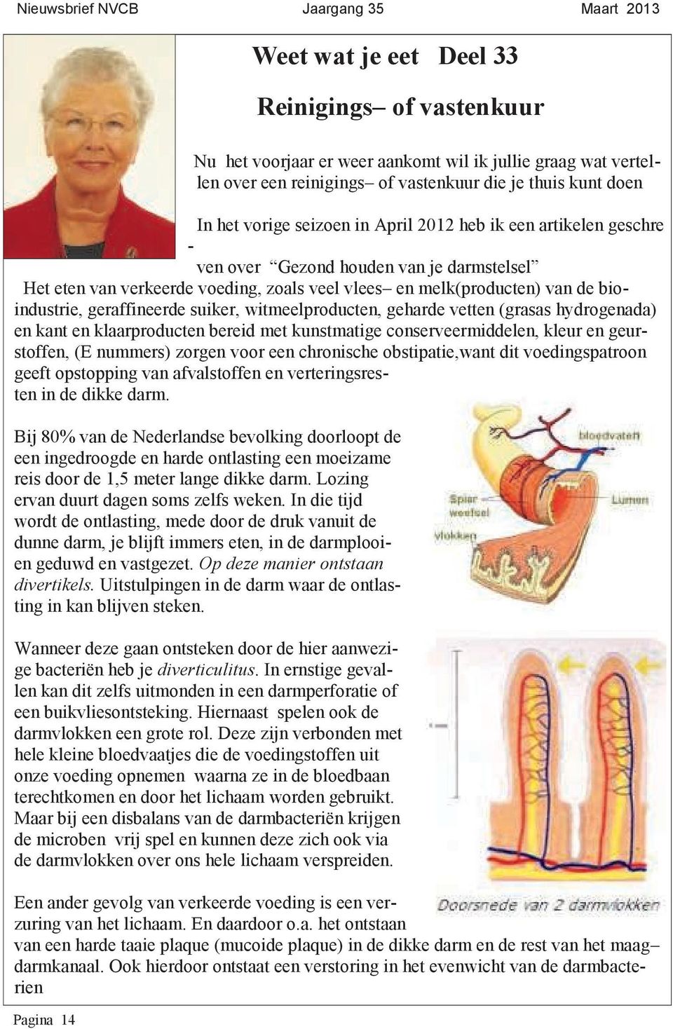 suiker, witmeelproducten, geharde vetten (grasas hydrogenada) en kant en klaarproducten bereid met kunstmatige conserveermiddelen, kleur en geurstoffen, (E nummers) zorgen voor een chronische