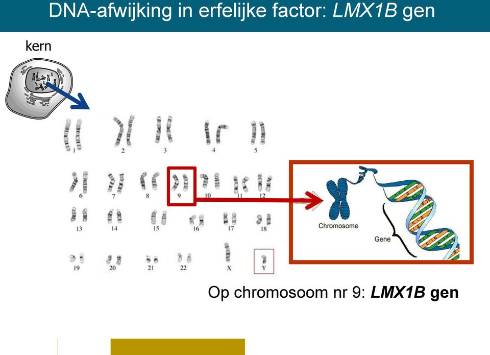 factor: LMX1B gen