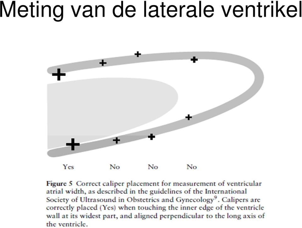 laterale