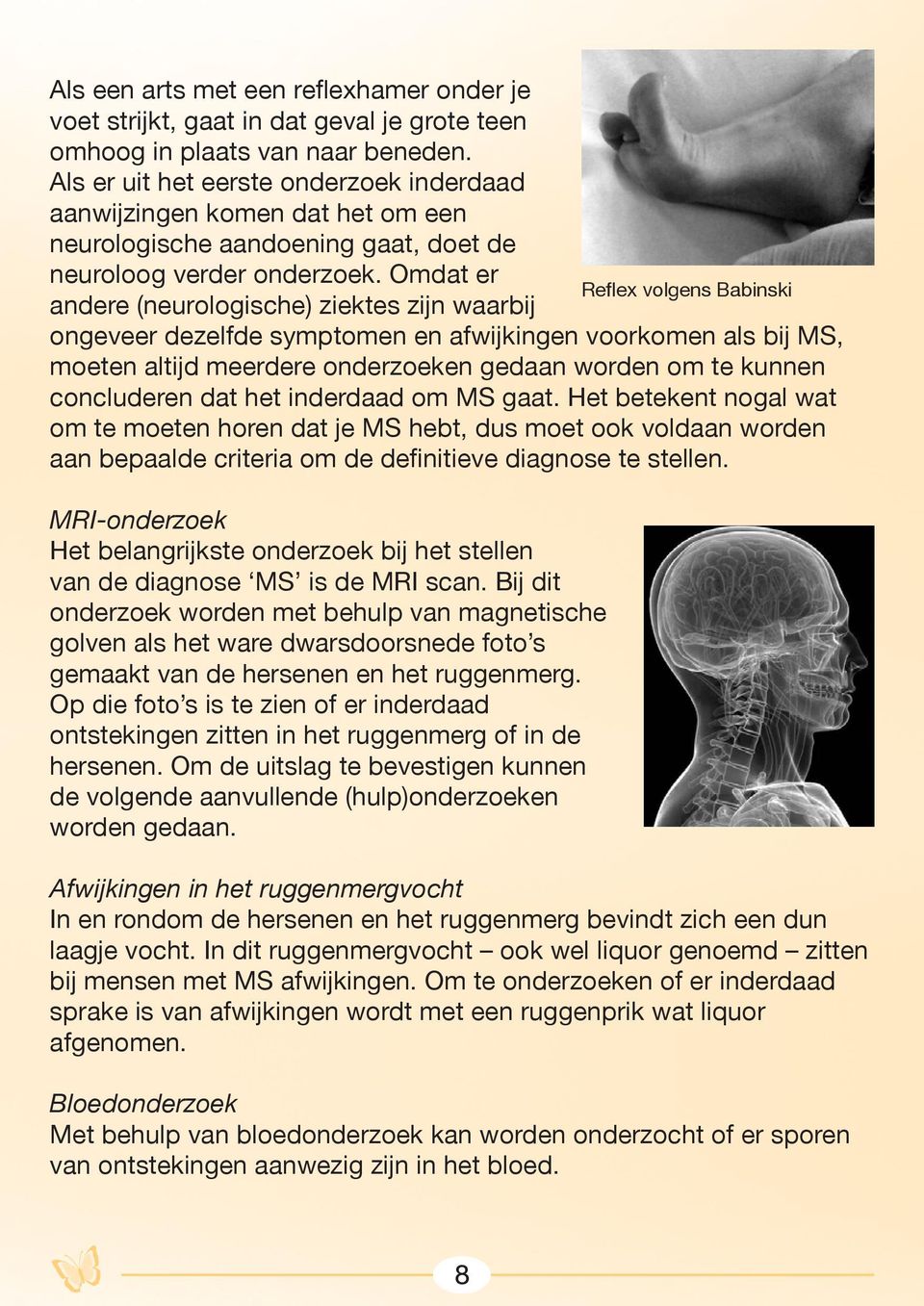 Omdat er Reflex volgens Babinski andere (neurologische) ziektes zijn waarbij ongeveer dezelfde symptomen en afwijkingen voorkomen als bij MS, moeten altijd meerdere onderzoeken gedaan worden om te