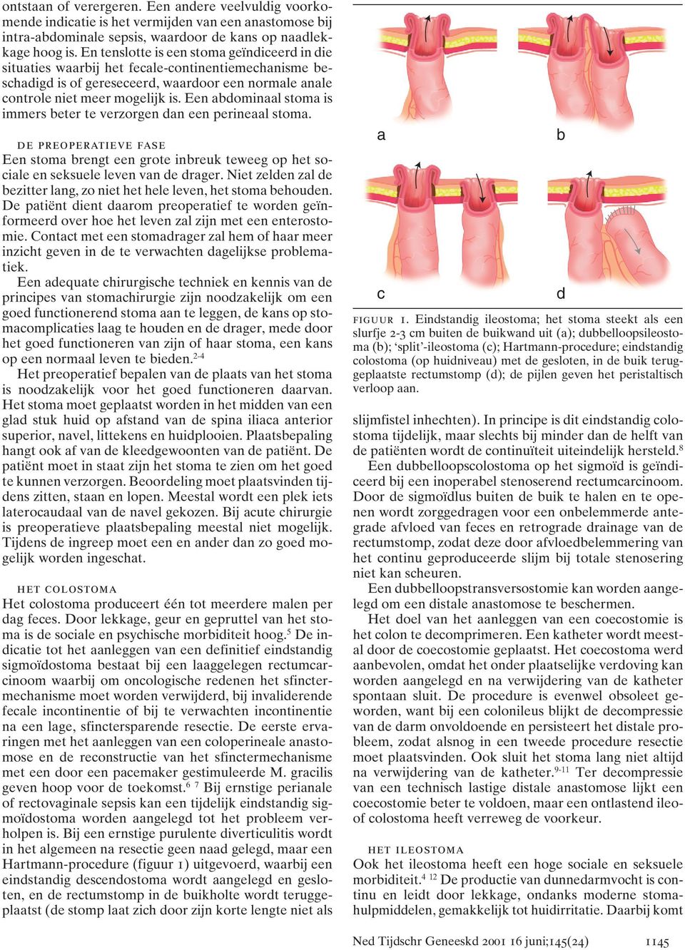 Een abdominaal stoma is immers beter te verzorgen dan een perineaal stoma. de preoperatieve fase Een stoma brengt een grote inbreuk teweeg op het sociale en seksuele leven van de drager.