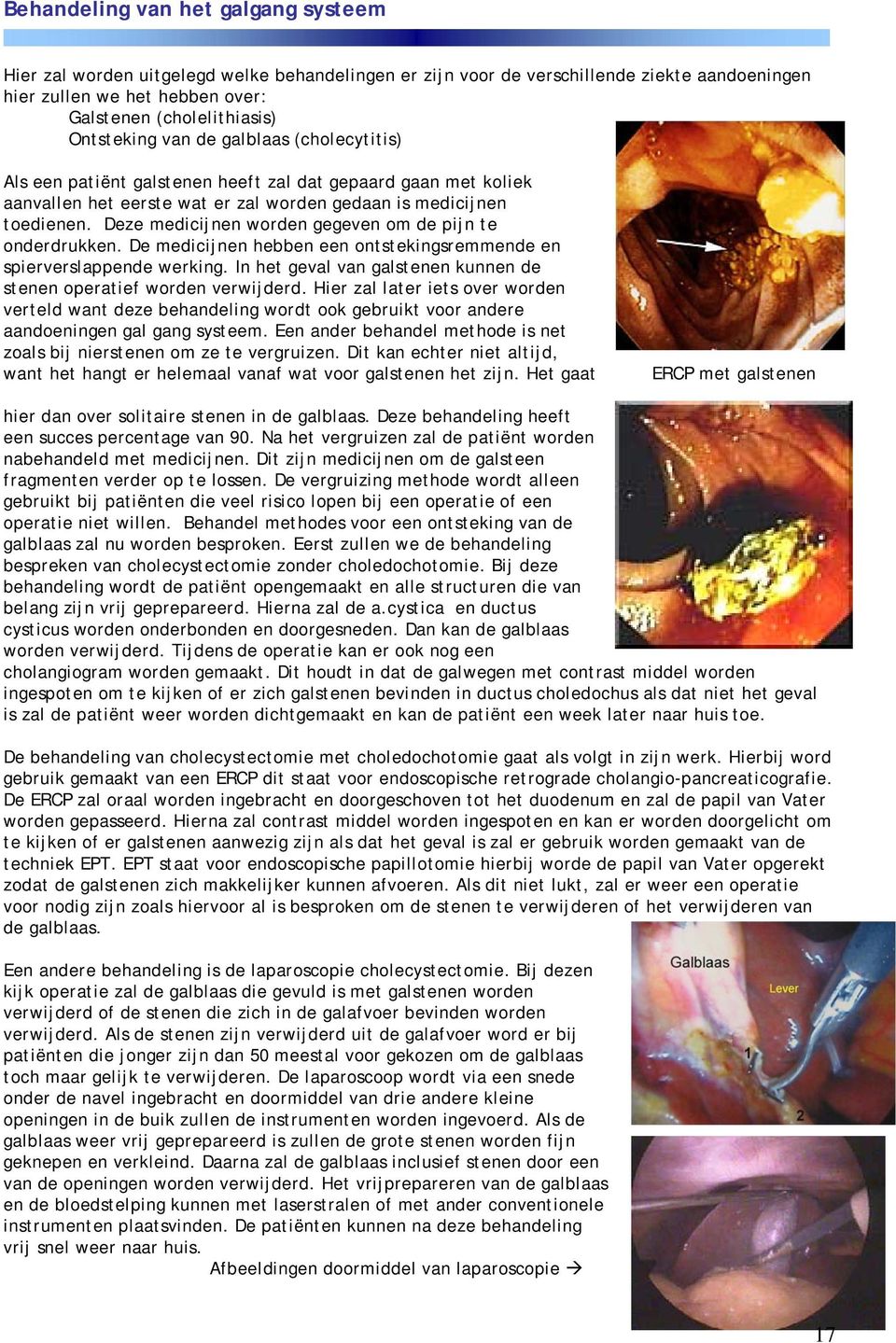 Deze medicijnen worden gegeven om de pijn te onderdrukken. De medicijnen hebben een ontstekingsremmende en spierverslappende werking.