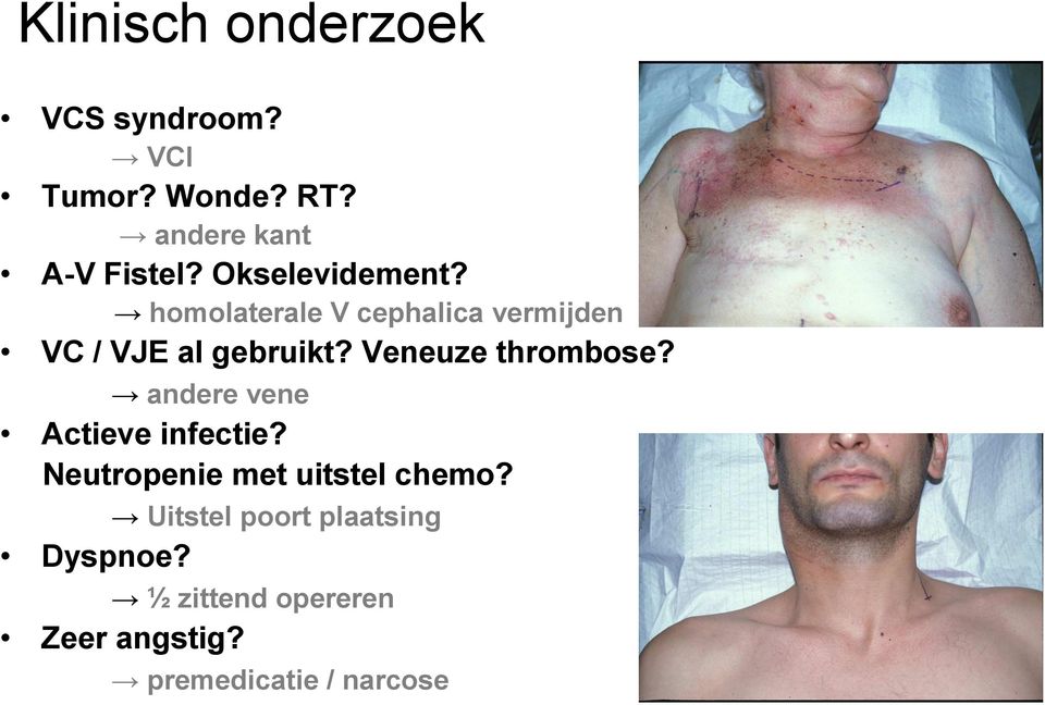 Veneuze thrombose? andere vene Actieve infectie? Neutropenie met uitstel chemo?