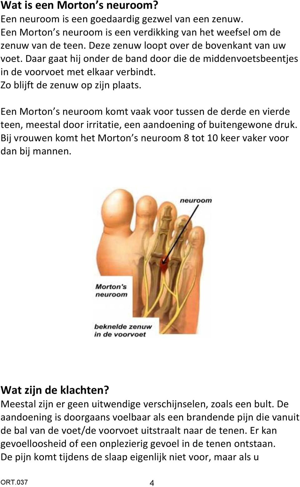 Een Morton s neuroom komt vaak voor tussen de derde en vierde teen, meestal door irritatie, een aandoening of buitengewone druk.