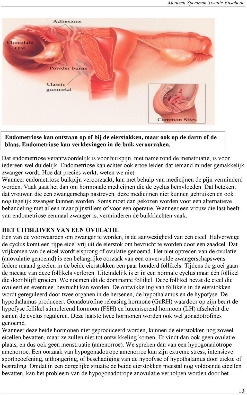 Hoe dat precies werkt, weten we niet. Wanneer endometriose buikpijn veroorzaakt, kan met behulp van medicijnen de pijn verminderd worden.