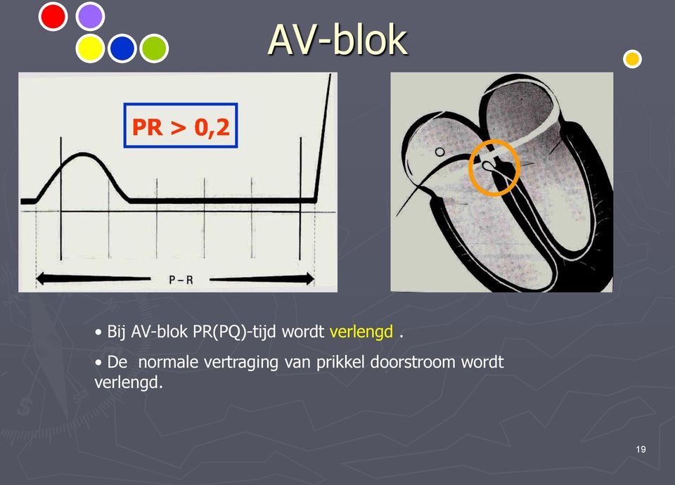 De normale vertraging van