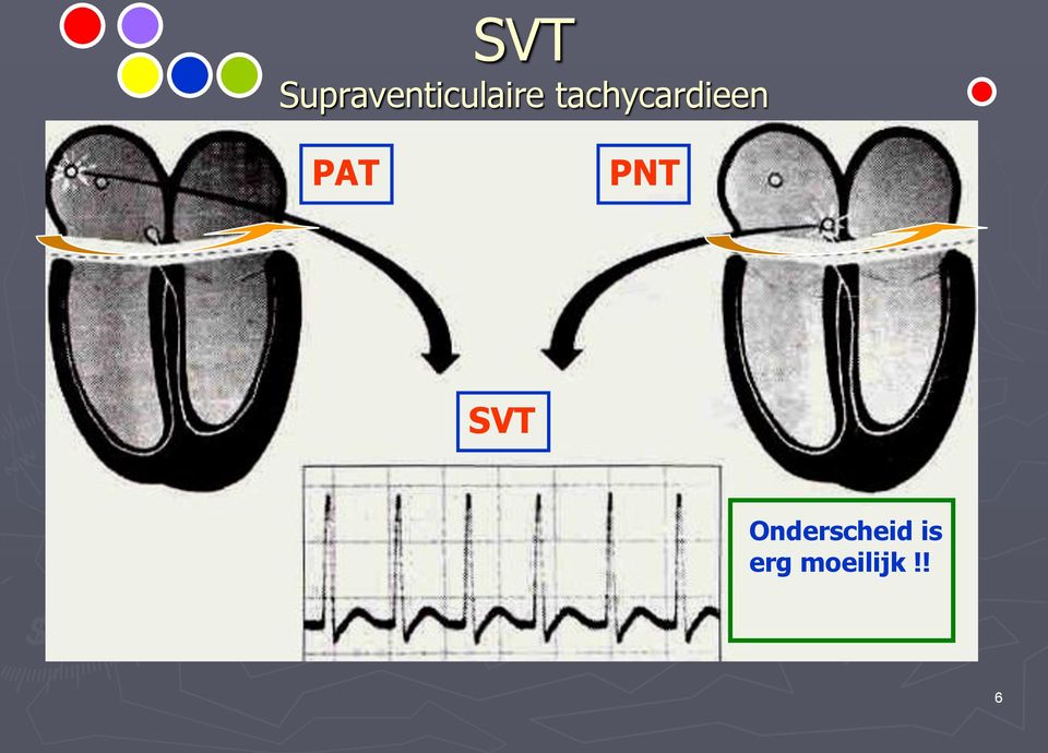 tachycardieen PAT