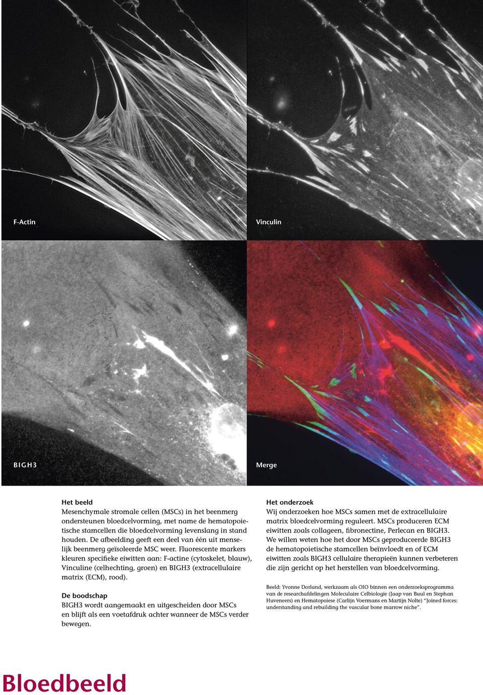 Fluorescente markers kleuren specifieke eiwitten aan: F-actine (cytoskelet, blauw), Vinculine (celhechting, groen) en BIGH3 (extracellulaire matrix (ECM), rood).
