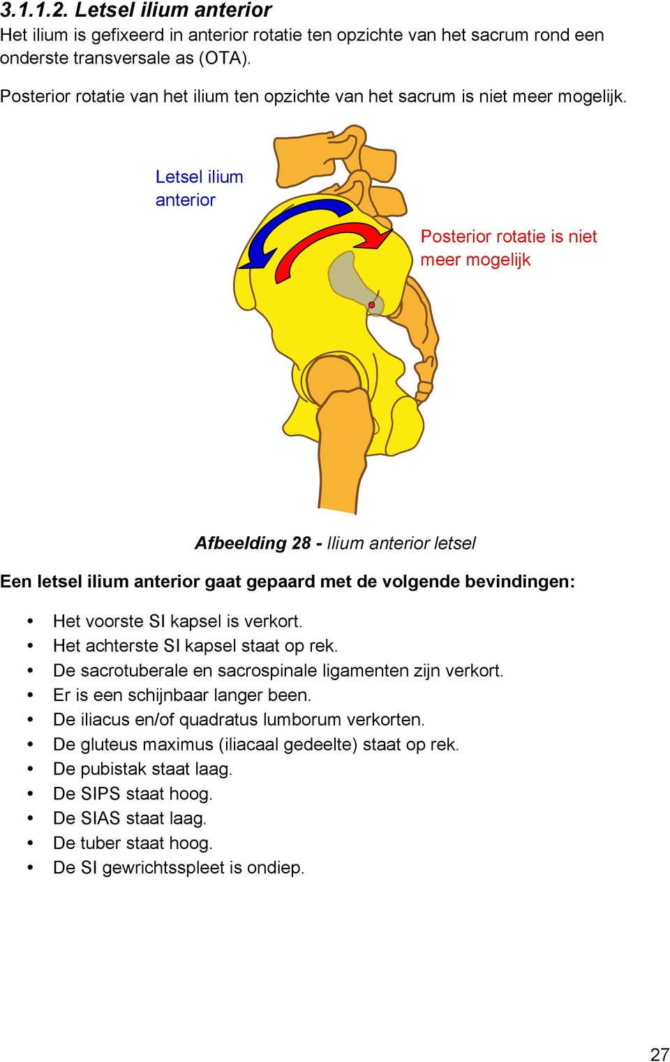Letsel ilium anterior Posterior rotatie is niet meer mogelijk Afbeelding 28 - Ilium anterior letsel Een letsel ilium anterior gaat gepaard met de volgende bevindingen: Het voorste SI kapsel is